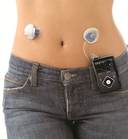 First insulin pump that acts like an artificial pancreas launched for  people with type 1 diabetes | Diabetes Research &amp; Wellness Foundation