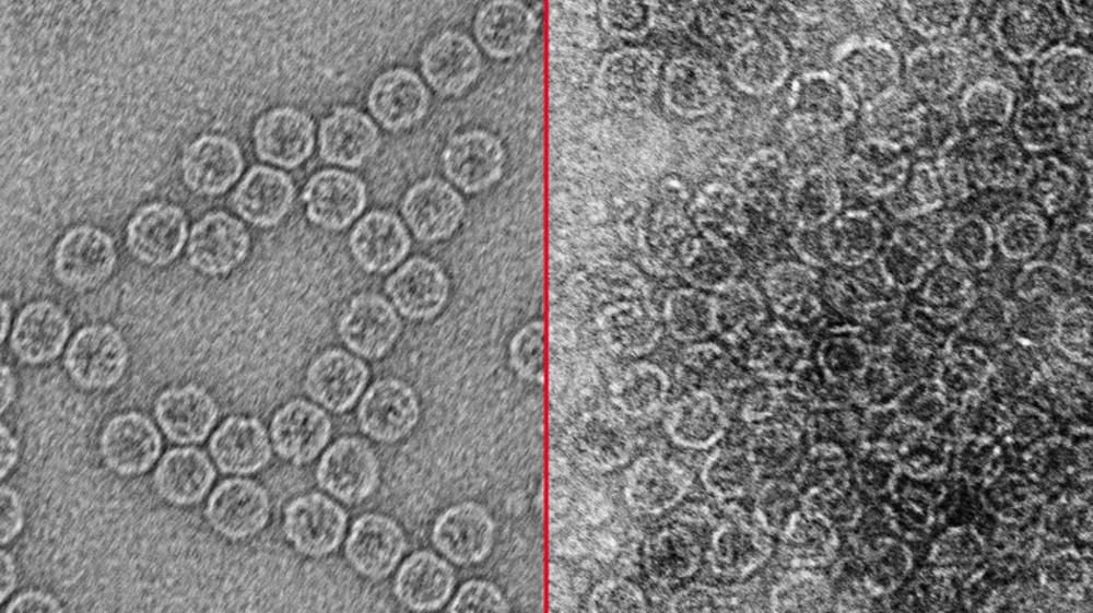 Transmission electron micrographs of a nonenveloped virus, MS2 bacteriophage, before electrocoagulation (left) and after (right).