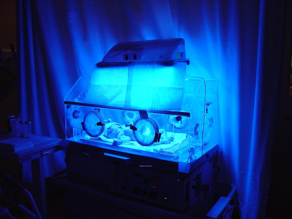 "Pasha in incubator with blue light" by SilentObserver is licensed under CC BY 2.0
