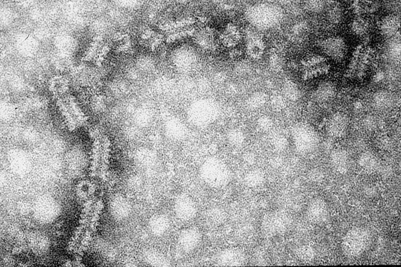 File:Mumps virus electron micrograph.jpg