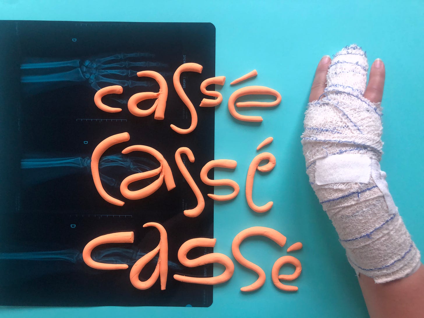 Clay letters that read "Cassé cassé cassé" or "broken broken broken" on a paper and xray background. On the right is a broken hand wrapped in bandages.