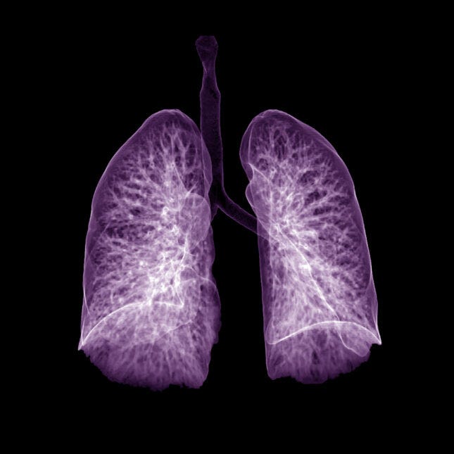 purple lungs ct