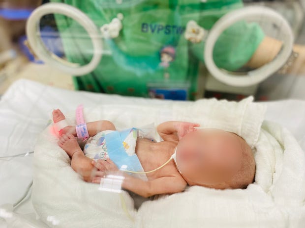 Kỳ tích cứu sống bé gái sinh non nhẹ cân nhất Việt Nam chỉ nặng 400 gram - Ảnh 1.