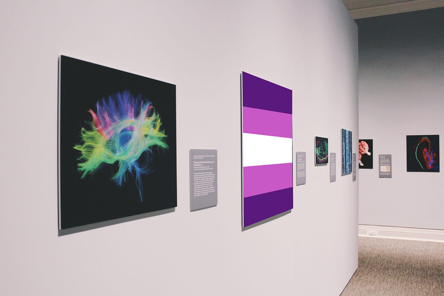 A sock image of a photo gallery with neuroscience art depicting the nervous system. One of the works of art has been overlaid with an image of the trans feminist flag (in order top-down, purple, pink, white, pink, and purple stripes).