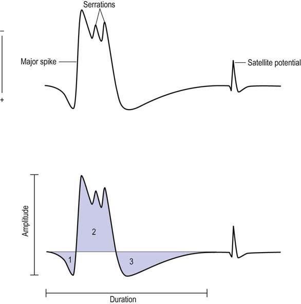 Basic Electromyography: Analysis of Motor Unit Action Potentials | Clinical  Gate