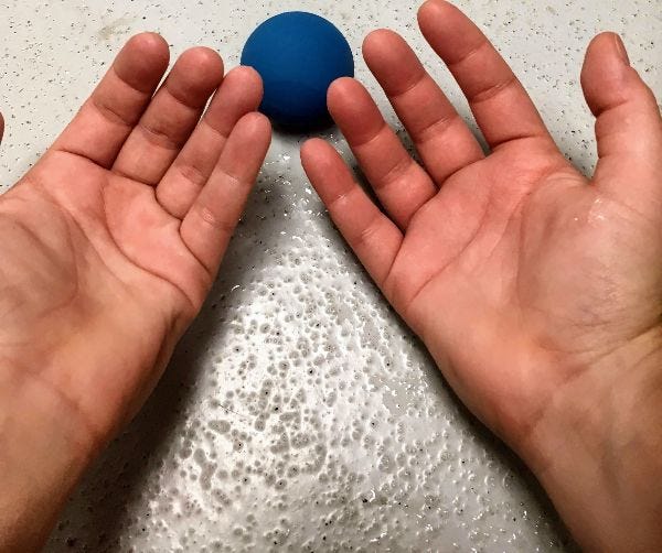 white hands, palms up on a table, next to a blue handball ball. The right hand is swollen and larger than the left hand
