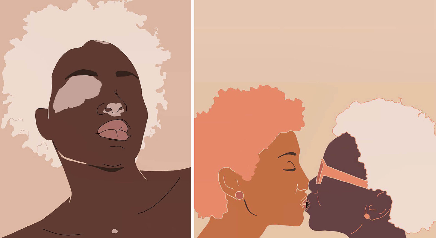 Vitiligo, Digital image (L) and  Love is love, Digital image (R), Gucora Andu | Illustrative Chronicles | STIRworld