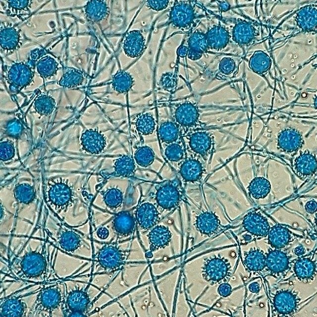 Histoplasma capsulatum...my favorite of the deadlies!!! #micro  #microbiology #nerdgasm #funinfungi | Microbiology, Fungi, Laboratory  science