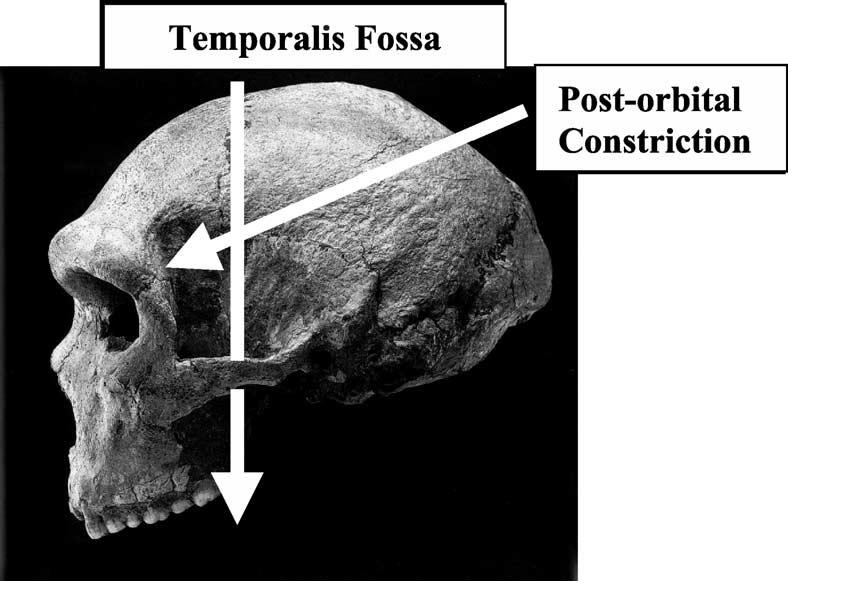 Brain size, IQ, and racial-group differences - Evidence from musculoskeletal traits (Figure 3)