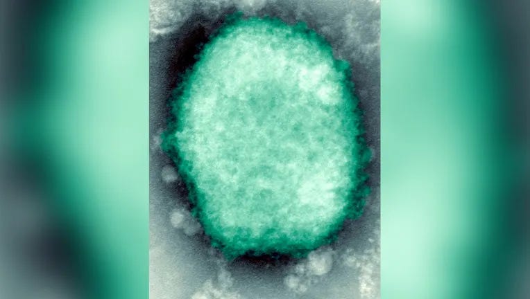 Monkeypox virus (cacar monyet)