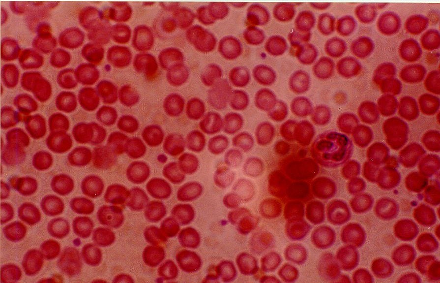 Medical Pictures Info – Červené krvinky