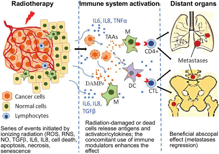 Diagram ilustrating the immune mediated abscopal effect ...