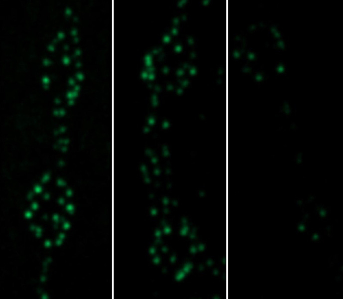 Three columns with black backgrounds show blurry green dots. They are brigther on the left (the experimental control)