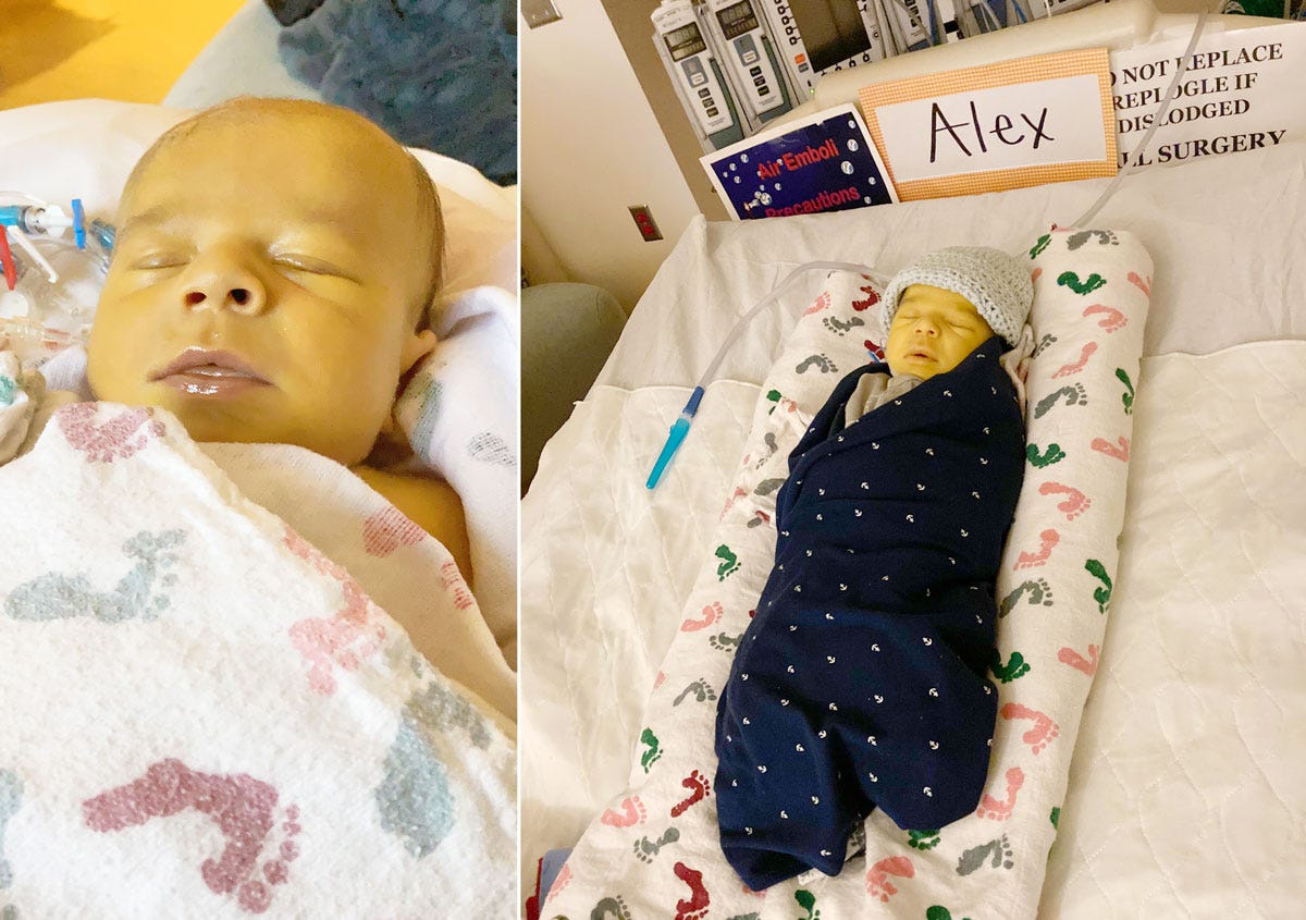 Baby Alex Before and After Passing