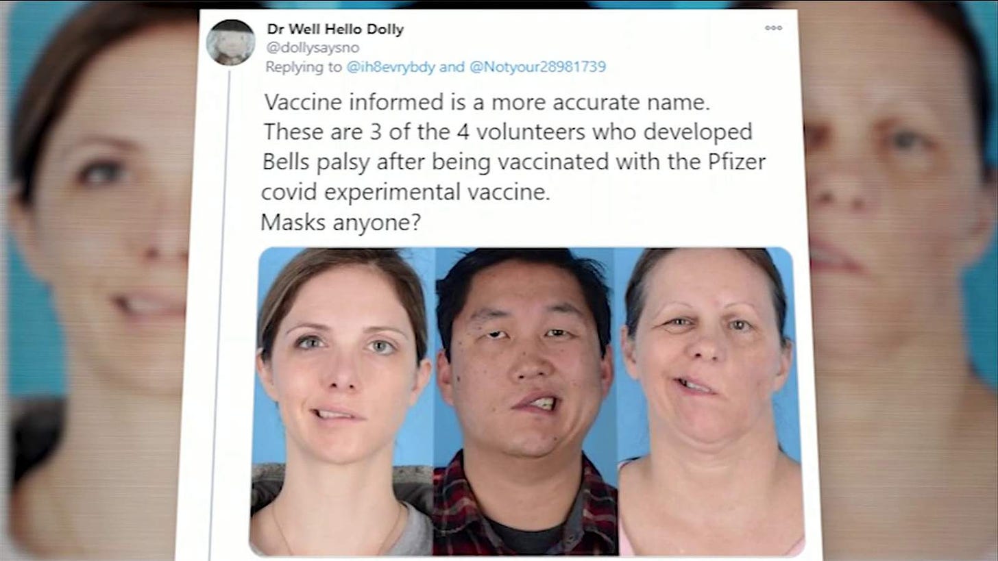 Is there a link between Bell's palsy and vaccines? - Florida News Times