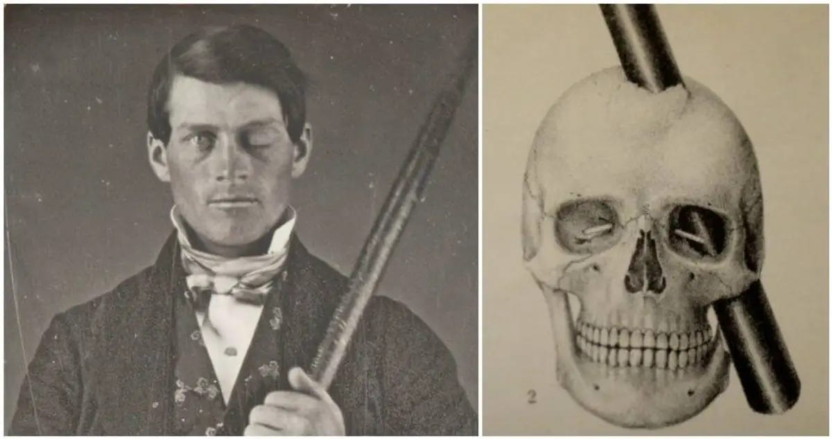 Phineas Gage, The Man Behind History's Most Famous Brain Injury