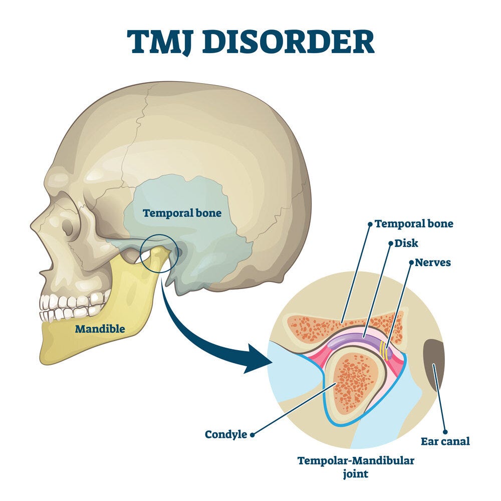 Temporomandibular Joint (TMJ) Treatment — Wellness Institute Medical &  Physical Therapy