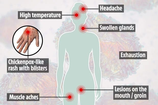 The chart above shows the different monkeypox symptoms and what you should look out for