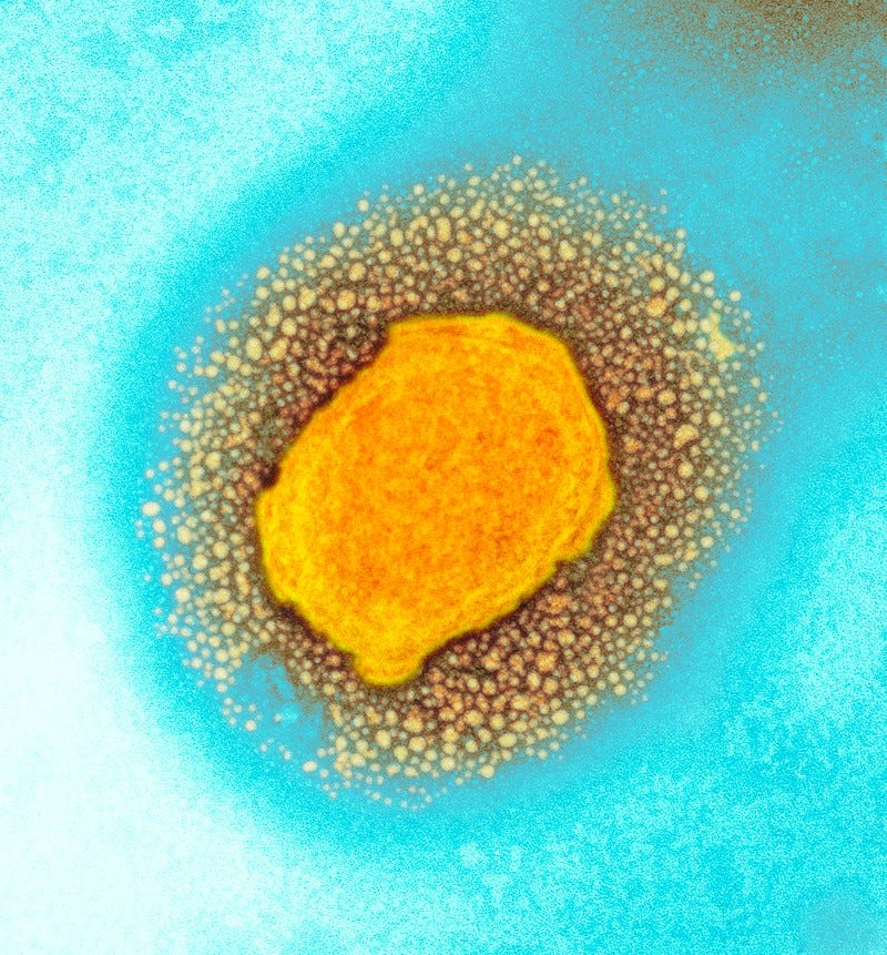 Coloured transmission electron micrograph of a yellow Monkeypox virus particle on a blue background