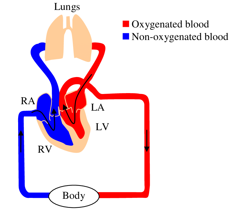 Circulatory system diagram showing the four chambers of the heart, lungs and body. Oxygenated blood from the lungs is pumped through the left atrium and ventricle to the body (and the heart muscle) through arteries. The non-oxygenated blood is returned by the veins to the right atrium and ventricle to be pumped back to the lungs for oxygenation.