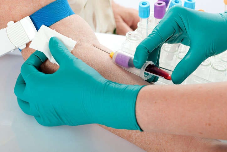 Tips for a Successful Blood Draw