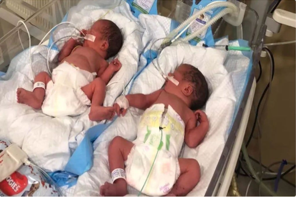 Premature twin babies Lenny and Moishe rescued by Project DYNAMO's mission 'GEMINI.' The babies were transported from Ukraine to Poland. (Project DYNAMO)