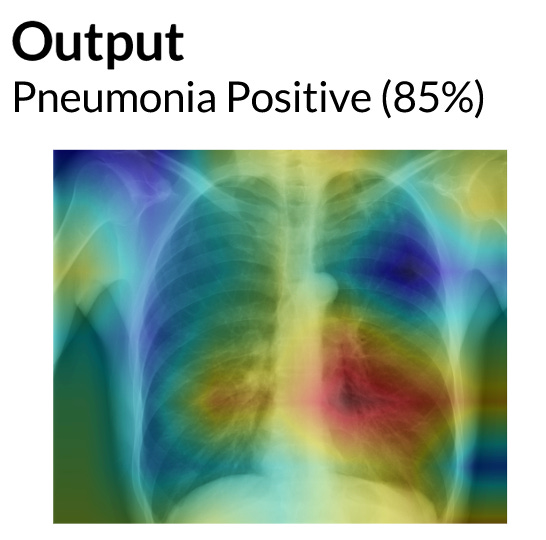 AI looking at a chest X-ray