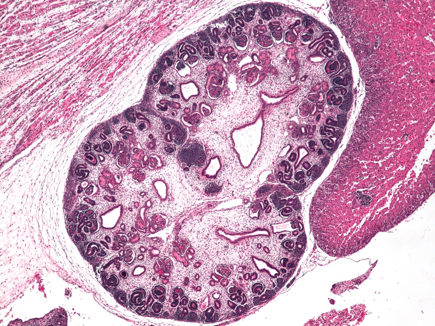 File:Human embryo kidney.jpg - Wikimedia Commons