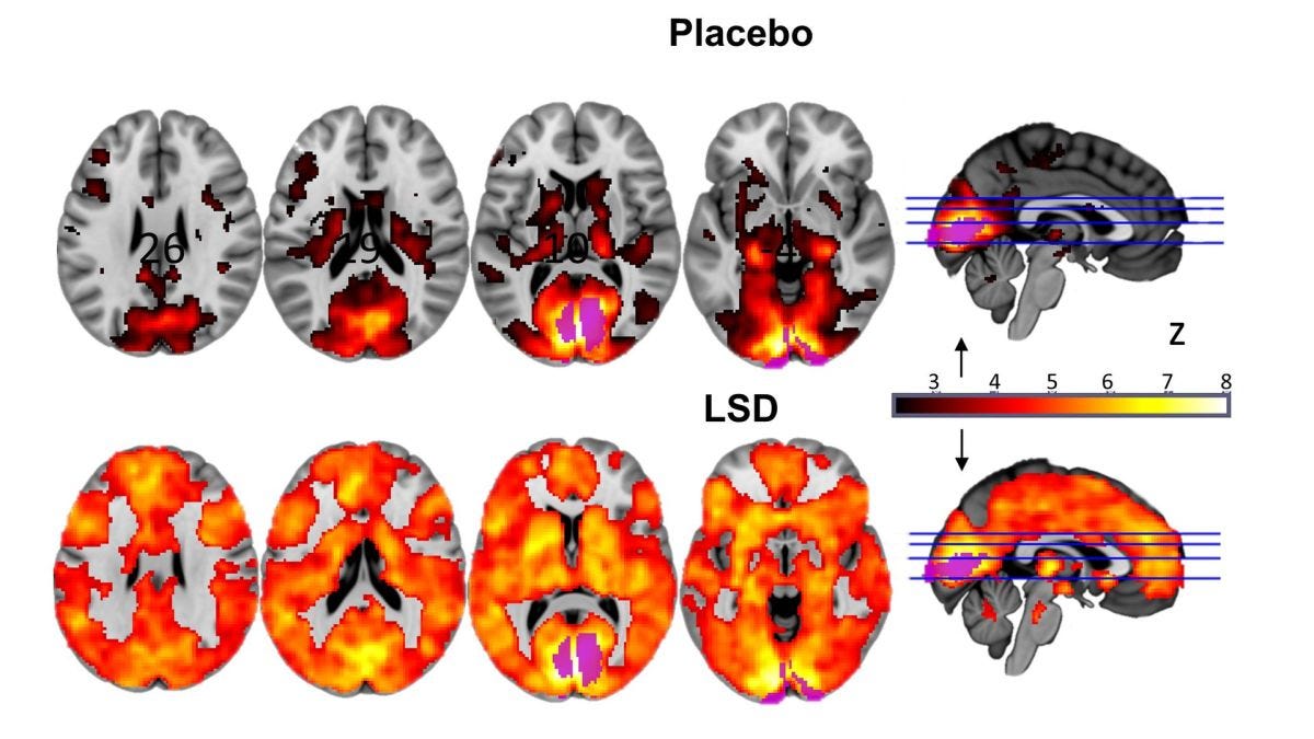 This is your brain on LSD, literally - CNN