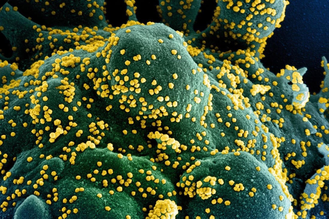 A coronavirus subvariant surging in China may be evolving to attack the brain, researchers say. Photo: EPA-EFE