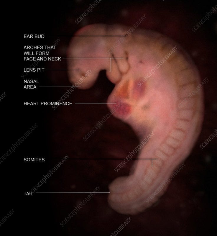 Embryo, Week 6 - Stock Image - C043/6965 - Science Photo Library