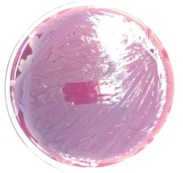 weak beta-hemolysis on sheep blood agar