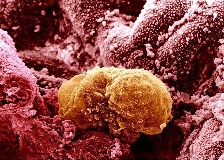 Scanning electron micrograph of a 6 day old human embryo