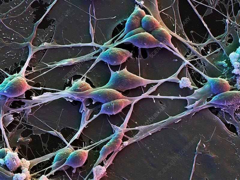 Brain cells, SEM - Stock Image - C016/7138 - Science Photo Library