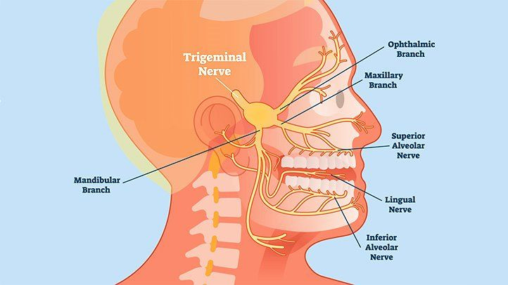 What Is Trigeminal Neuralgia? | Everyday Health