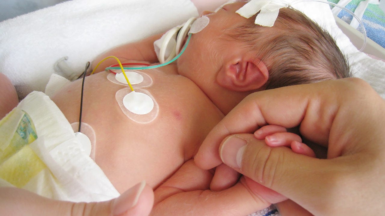 The NICU & your baby: what to expect | Raising Children Network