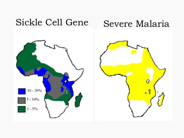 How AI is Joining the Fight Against Malaria and Sickle Cell Disease — AI  Daily - Artificial Intelligence News