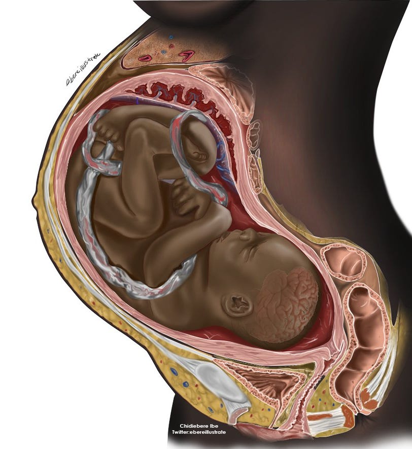 Medical illustration of a Black foetus inside the womb by Ch