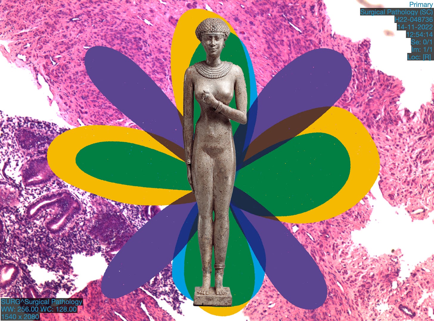 Collage comprised of a biopsy from some tissue removed from yours truly, layered painting and a 610–595 B.C. statuette of a royal woman
