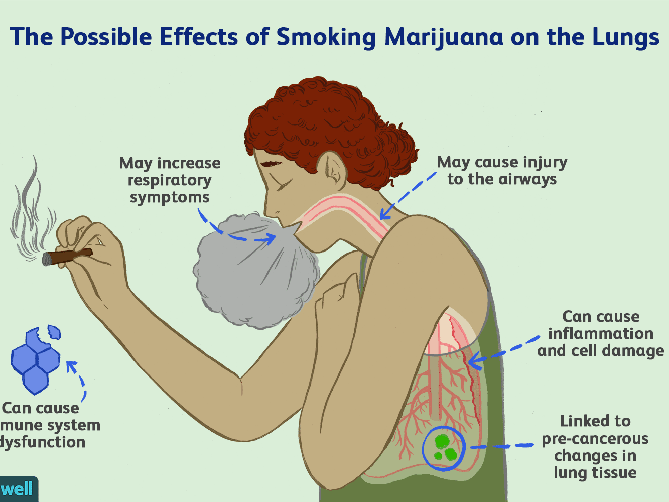 Does Smoking Marijuana Cause Lung Cancer?