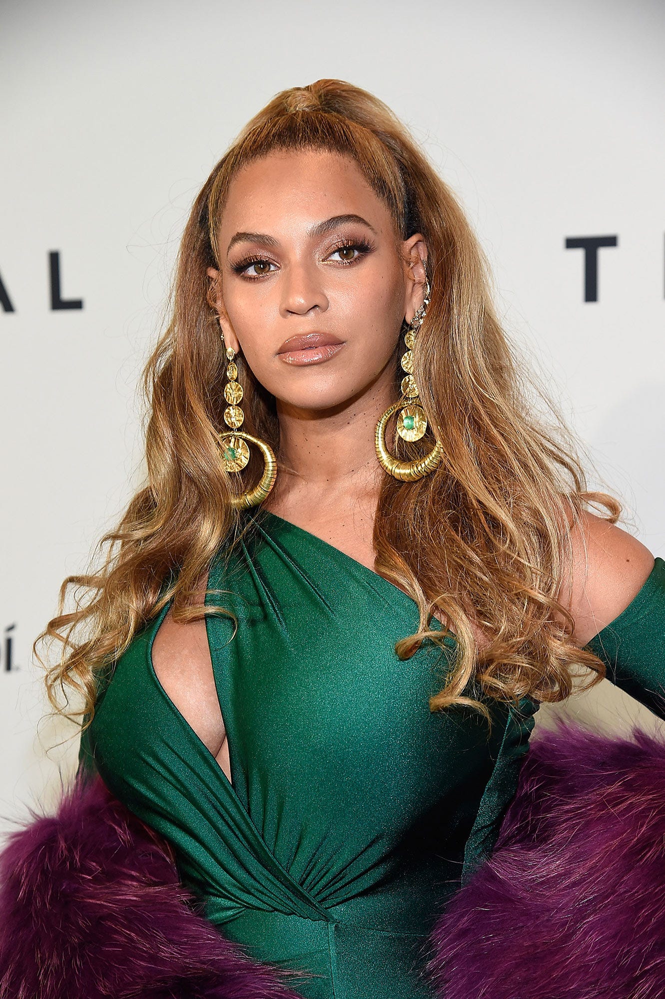 Who Bit Beyoncé? The Internet Demands to Know | Vogue