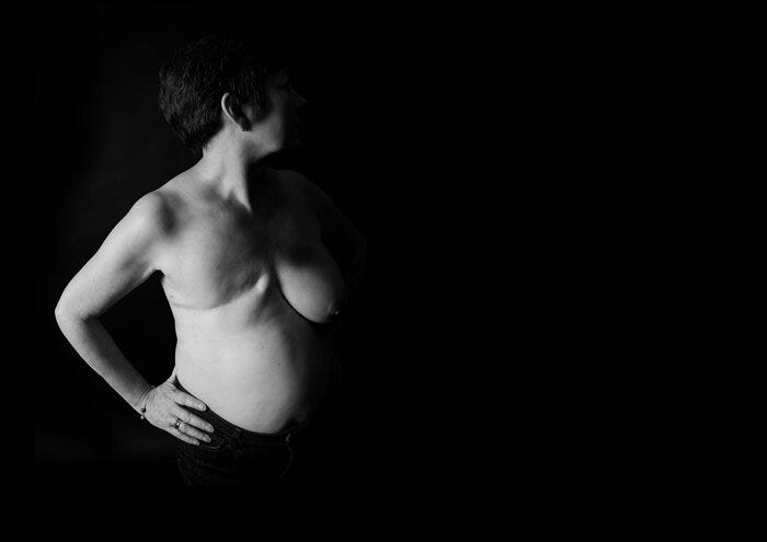 Image by Ami Barwell from her series Mastectomy
