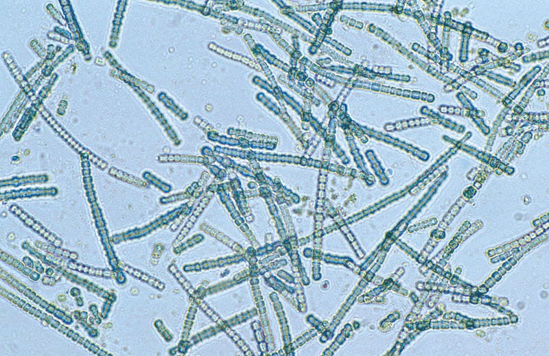 File:CSIRO ScienceImage 4203 A bluegreen algae species Cylindrospermum sp under magnification.jpg