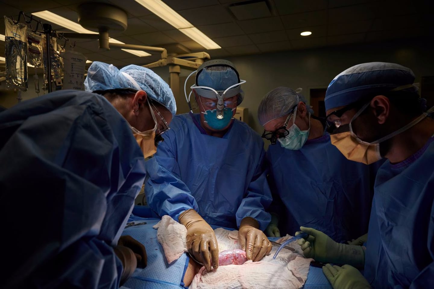 A surgical team at the hospital in New York examined a pig kidney attached to the body of a deceased recipient for any signs of rejection in September. From left to right are Drs. Zoe A. Stewart-Lewis, Robert A. Montgomery, Bonnie E. Lonze, and Jeffrey Stern.