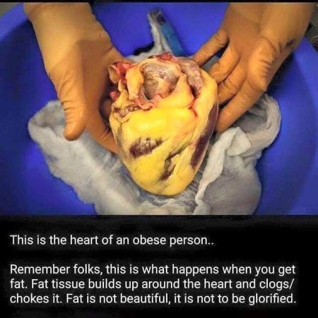 Fat Heart