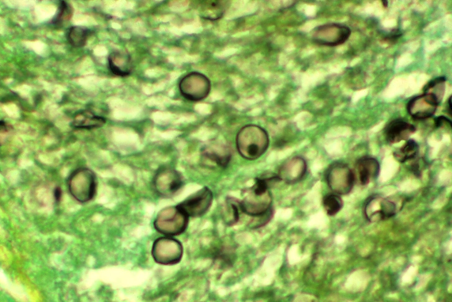 Pneumocystis jirovecii - Wikipedia