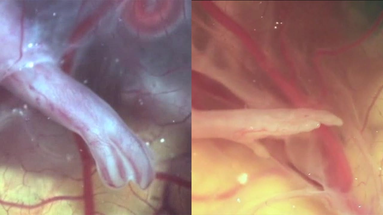 From dinosaur to chicken, hind limb development of chicken embryos - YouTube