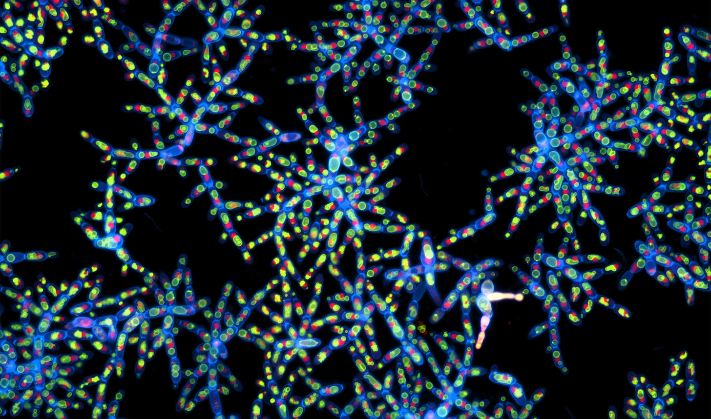 Micrograph of snowflake yeast.