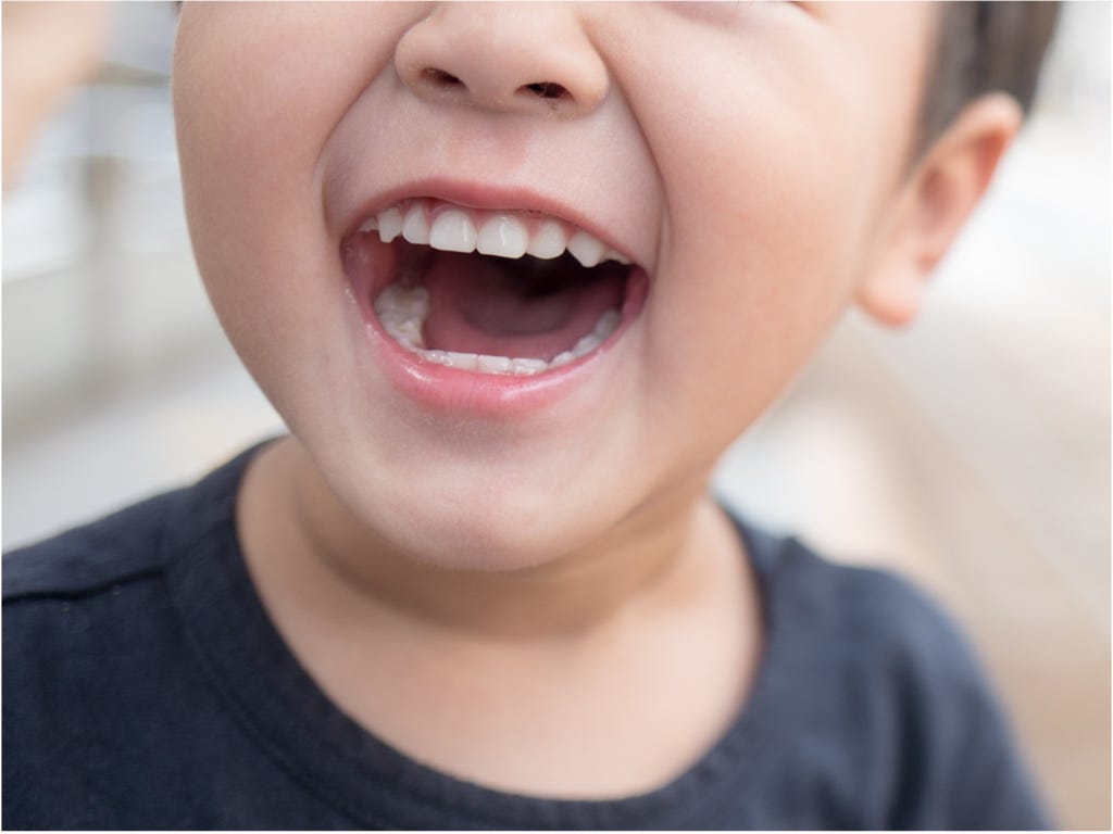 A photo of a child’s bared teeth by kazuend on Unsplash