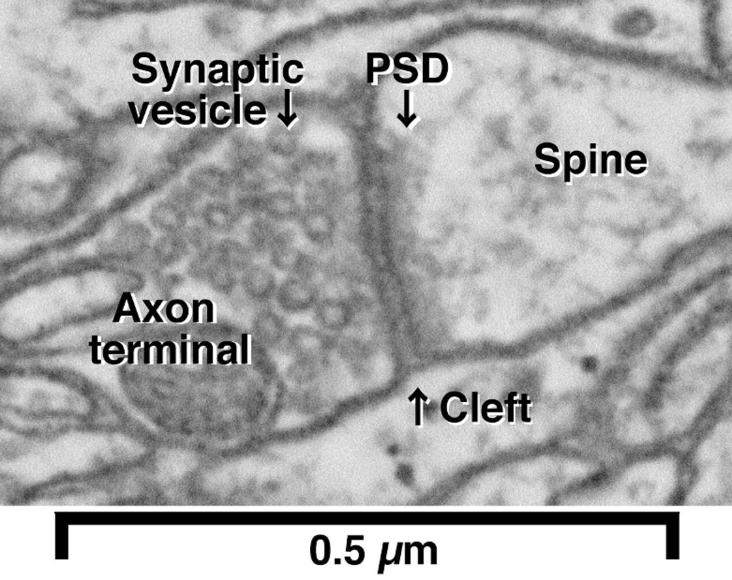 Reconstructing Brain Circuits - Microscopy